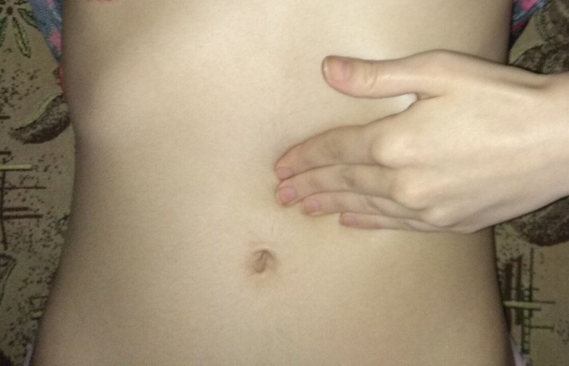 Egészséges gyomor a NEOflorax kapszula kezelés után