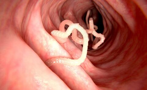 férgek az emberi testben