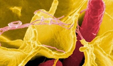 A paraziták jelei az emberi testben