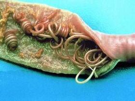 A paraziták okai az emberi testben