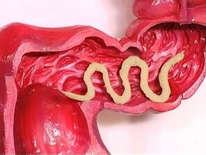 paraziták az emberi testben, miért jelennek meg