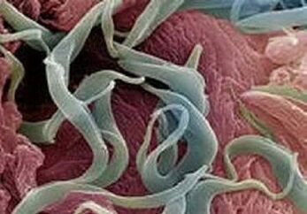 A paraziták tünetei és kezelése az emberi testben