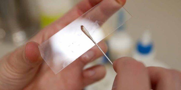 A paraziták bőrkaparása