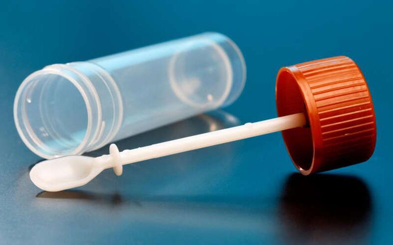 széklet teszt férgek számára