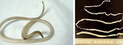 paraziták típusai az emberi szervezetben