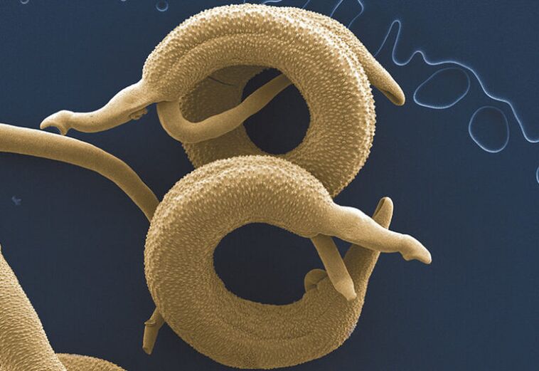 az emberi szervezetben élő paraziták